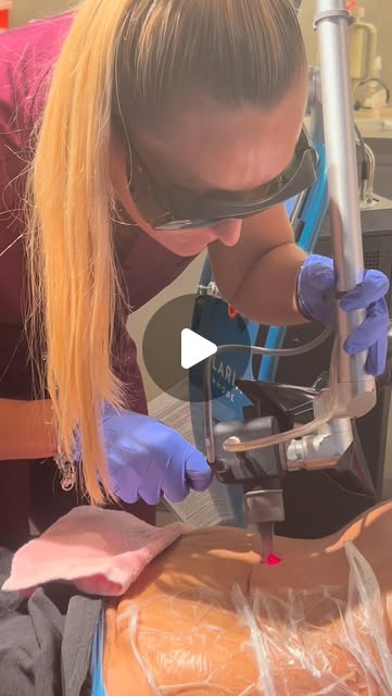 Laser treatment featured in an Instagram reel