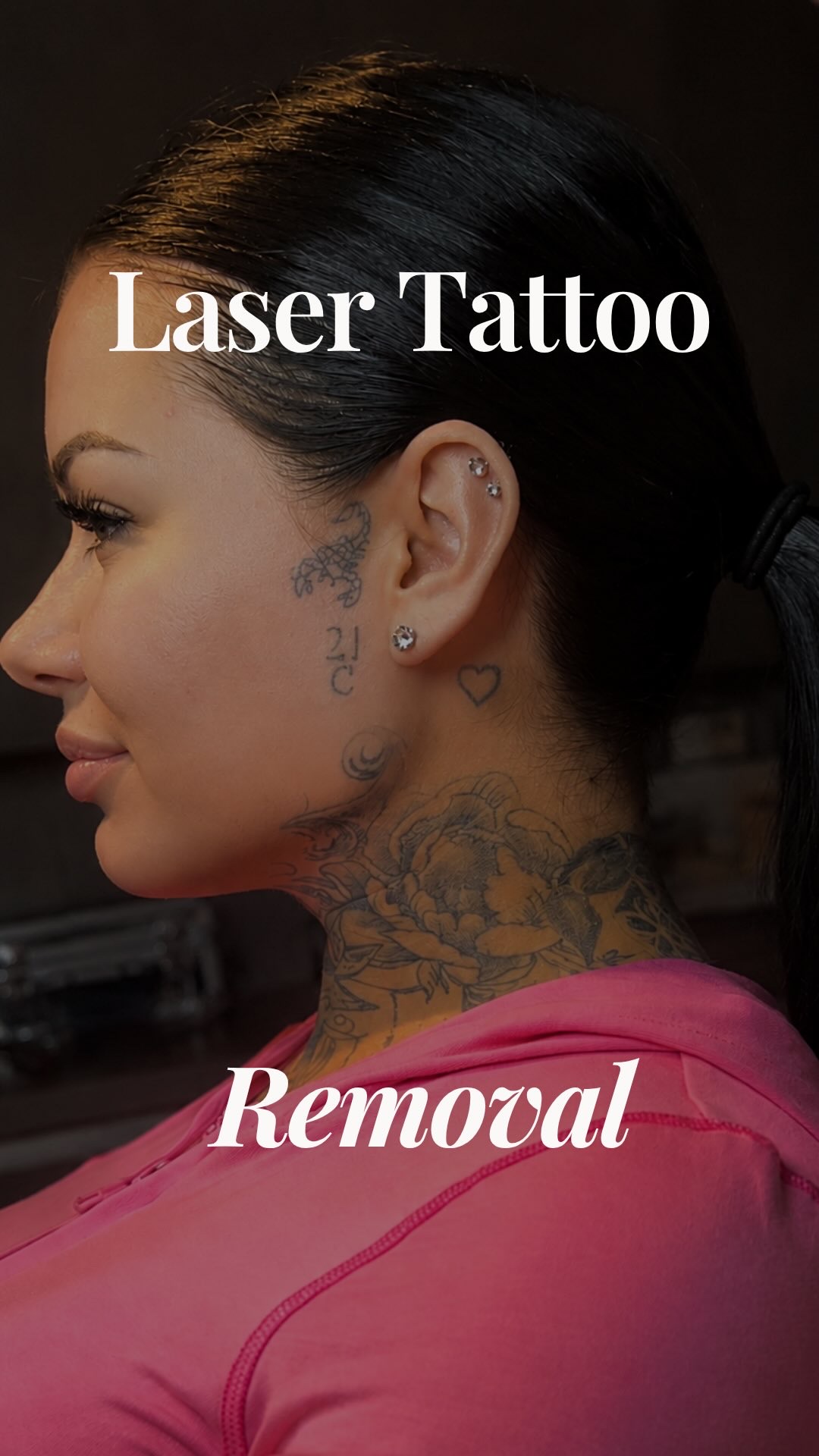 Client featured in an official Face and Body Labs laser tattoo removal post